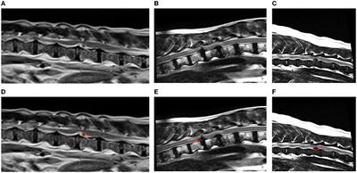 Magnetic resonance imaging features of canine intradural/extramedullary intervertebral disc extrusion in seven cases